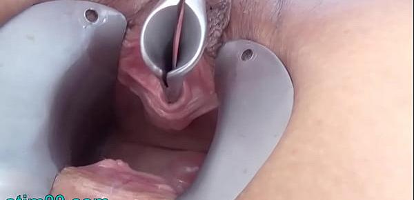  Masturbate Peehole with Toothbrush and Chain into Urethra